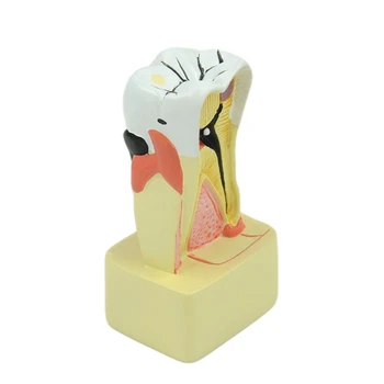 Dropship Zubné Model Periodontal Analýzy pre Zubár Výučby na Klinike Stomatológie